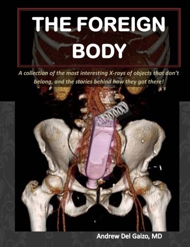 The Foreign Body: A Collection of the Most Interesting X-Rays of Things That Don’t Belong and the Stories Behind How They Got There!
